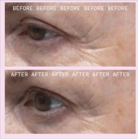 Josie Maran Beta-Retinoid Serum - Full Size! - Picture 8 of 10